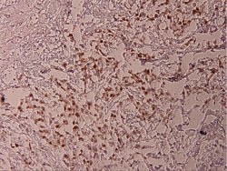 Phospho-ATF2 (Thr69) Polyclonal Antibody, Invitrogen 100 &mu;L; Unconjugated:Antibodies,