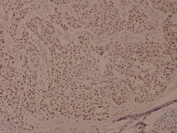 Invitrogen Phospho-BRCA1 (Ser1524) Polyclonal Antibody 100 &mu;L; Unconjugated:Antibodies,