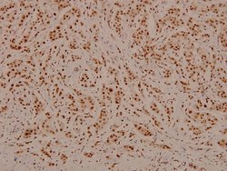 Invitrogen Phospho-C/EBP beta (Thr188, Thr235) Polyclonal Antibody 100