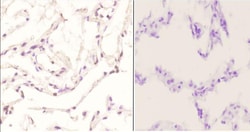 Phospho-c-Jun (Tyr170) Polyclonal Antibody:Antibodies, Polyclonal