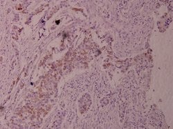 Invitrogen Phospho-TPL2 (Thr290) Polyclonal Antibody 100 &mu;L; Unconjugated:Antibodies,
