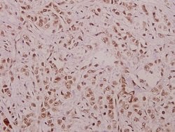 Invitrogen Phospho-Cyclin E (Thr395) Polyclonal Antibody 100 &mu;L; Unconjugated:Antibodies,