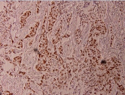 Invitrogen Phospho-ELK1 (Thr417) Polyclonal Antibody 100 &mu;L; Unconjugated:Antibodies,