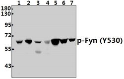 Invitrogen Phospho-Fyn (Tyr530) Polyclonal Antibody 100 &mu;L; Unconjugated:Antibodies,
