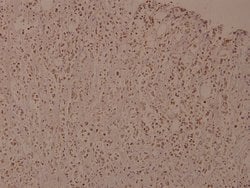 Invitrogen Phospho-IKK beta (Tyr188) Polyclonal Antibody 100 &mu;L; Unconjugated:Antibodies,