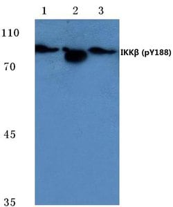Invitrogen Phospho-IKK beta (Tyr188) Polyclonal Antibody 100 &mu;L; Unconjugated:Antibodies,
