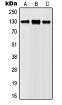 Invitrogen Phospho-JAK1 (Tyr1022) Polyclonal Antibody 100 &mu;L | Buy Online | Invitrogen&trade; | Fisher Scientific