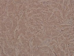 Invitrogen Phospho-JAK1 (Tyr1022) Polyclonal Antibody 100 &mu;L | Buy Online | Invitrogen&trade; | Fisher Scientific
