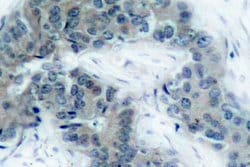 Invitrogen Phospho-JAK2 (Tyr1007) Polyclonal Antibody 100 &mu;L; Unconjugated:Antibodies,