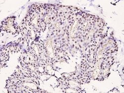 Invitrogen Phospho-LIMK1 (Thr508) Polyclonal Antibody 100 &mu;L; Unconjugated:Antibodies,