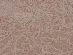 Phospho-MEF2A (Thr319) Polyclonal Antibody:Antibodies, Polyclonal
