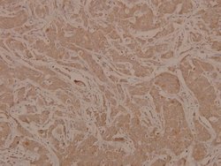 Invitrogen Phospho-MEK6 (Ser207) Polyclonal Antibody 100 &mu;L; Unconjugated:Antibodies,