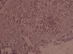 Invitrogen Phospho-c-Myc (Ser373) Polyclonal Antibody 100 &mu;L; Unconjugated:Antibodies,