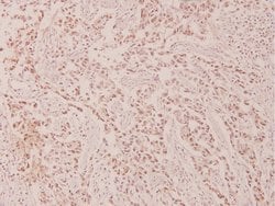 Invitrogen Phospho-c-Myc (Thr58) Polyclonal Antibody 100 &mu;L; Unconjugated:Antibodies,