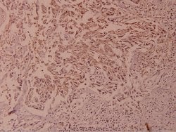 Invitrogen Phospho-NFkB p100 (Ser866) Polyclonal Antibody 100 &mu;L; Unconjugated:Antibodies,