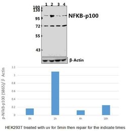 Invitrogen Phospho-NFkB p100 (Ser866) Polyclonal Antibody 100 &mu;L; Unconjugated:Antibodies,