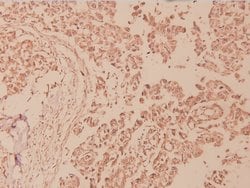 Invitrogen Phospho-NFkB p100 (Ser870) Polyclonal Antibody 100 &mu;L; Unconjugated:Antibodies,