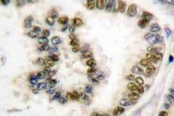 Phospho-SRF (Ser103) Polyclonal Antibody:Antibodies, Polyclonal