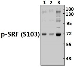 Phospho-SRF (Ser103) Polyclonal Antibody:Antibodies, Polyclonal