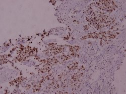 Invitrogen Phospho-STAT5 alpha (Ser780) Polyclonal Antibody 100 &mu;L;