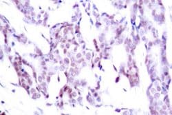 Invitrogen Phospho-STAT6 (Thr645) Polyclonal Antibody 100 &mu;L; Unconjugated:Antibodies,