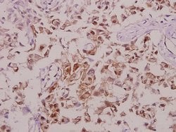 Invitrogen Phospho-Tyrosine Hydroxylase (Ser71) Polyclonal Antibody 100