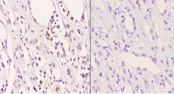 Invitrogen Phospho-AKT Pan (Thr450, Thr451, Thr447) Polyclonal Antibody