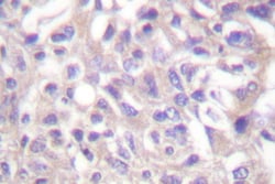 Invitrogen Phospho-alpha Adducin (Thr445) Polyclonal Antibody 100 &mu;L;