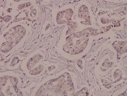 Invitrogen Phospho-ATP1A1 (Ser16) Polyclonal Antibody 100 &mu;L | Buy Online | Invitrogen&trade; | Fisher Scientific