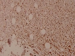 Phospho-MDM2 (Ser166) Polyclonal Antibody:Antibodies, Polyclonal