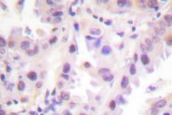 Invitrogen Phospho-ERF (Thr526) Polyclonal Antibody 100 &mu;L; Unconjugated:Antibodies,