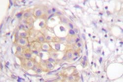 Invitrogen Phospho-FGFR1 (Tyr766) Polyclonal Antibody 100 &mu;L; Unconjugated:Antibodies,