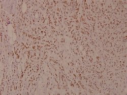 Invitrogen Phospho-MiTF (Ser180) Polyclonal Antibody 100 &mu;L; Unconjugated:Antibodies,