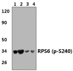 Invitrogen Phospho-S6 (Ser240) Polyclonal Antibody 100 &mu;L | Buy Online | Invitrogen&trade; | Fisher Scientific