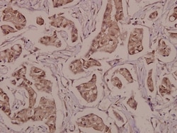 Invitrogen&trade;&nbsp;Phospho-PPAR gamma (Ser112) Polyclonal Antibody