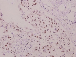 Invitrogen Phospho-p47phox (Ser304) Polyclonal Antibody 100 &mu;L; Unconjugated:Antibodies,