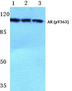 Invitrogen Phospho-Androgen Receptor (Tyr363) Polyclonal Antibody 100 &mu;L;