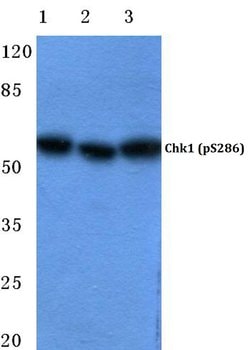 Invitrogen Phospho-CHK1 (Ser286) Polyclonal Antibody 100 &mu;L | Buy Online | Invitrogen&trade; | Fisher Scientific