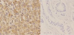 Invitrogen Phospho-Cytokeratin 18 (Ser52) Polyclonal Antibody 100 &mu;L;