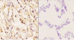 Invitrogen Phospho-Cytokeratin 8 (Ser74) Polyclonal Antibody 100 &mu;L;