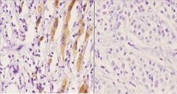 Invitrogen Phospho-Cytokeratin 8 (Ser74) Polyclonal Antibody 100 &mu;L;