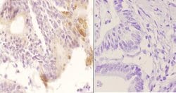 Invitrogen Phospho-Cytokeratin 8 (Ser74) Polyclonal Antibody 100 &mu;L;