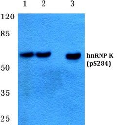Invitrogen Phospho-hnRNP K (Ser284) Polyclonal Antibody 100 &mu;L; Unconjugated:Antibodies,