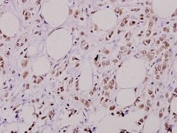 Invitrogen Phospho-AKT2 (Ser474) Polyclonal Antibody 100 &mu;L; Unconjugated:Antibodies,
