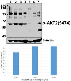 Invitrogen Phospho-AKT2 (Ser474) Polyclonal Antibody 100 &mu;L; Unconjugated:Antibodies,