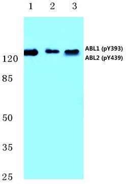 Invitrogen Phospho-ABL1/ABL2 (Tyr393, Tyr439) Polyclonal Antibody 100 &mu;L;