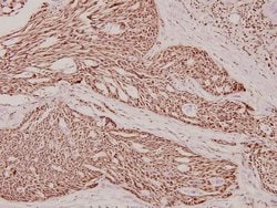 Invitrogen Phospho-beta Catenin (Ser37) Polyclonal Antibody 100 &mu;L;