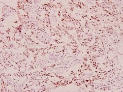 Invitrogen Phospho-BRCA1 (Ser1423) Polyclonal Antibody 100 &mu;L; Unconjugated:Antibodies,