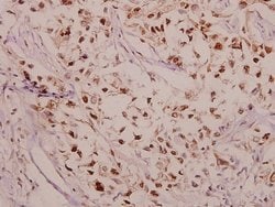Invitrogen Phospho-CPI-17 (Thr38) Polyclonal Antibody 100 &mu;L; Unconjugated:Antibodies,