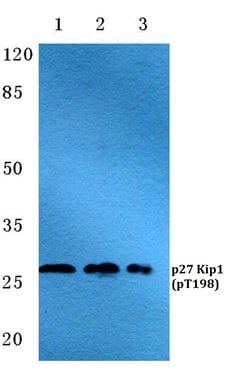 Invitrogen Phospho-p27 Kip1 (Thr198) Polyclonal Antibody 100 &mu;L; Unconjugated:Antibodies,